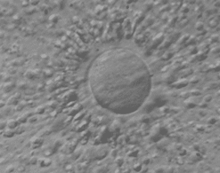 ivf treatment plan